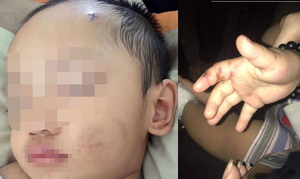 ​Điều tra nghi án bé trai 2 tuổi bị tình nhân của mẹ bạo hành