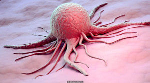 7 dấu hiệu tưởng vô hại nhưng cảnh báo các bệnh ung thư nguy hiểm