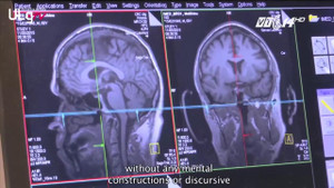 Bộ não đặc biệt của người đàn ông hạnh phúc nhất thế giới