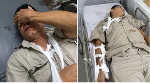 Nhóm côn đồ truy sát dã man người đàn ông 61 tuổi ở Hà Nội