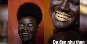 9 cô gái chứng minh tiêu chuẩn sắc đẹp không có giới hạn