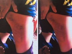 Bé trai 15 tuổi nghi bị công an xã đánh nhập viện do đi cùng bạn trộm xe gắn máy