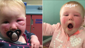 Tác hại đáng sợ của nắng đầu hè không phải ai cũng biết