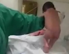 Y tá choáng váng khi thấy bé sơ sinh vừa lọt lòng đã biết đi