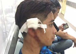 Đến phòng tập gym cùng bạn gái, bị nhân viên dùng bình cứu hỏa đánh vỡ đầu