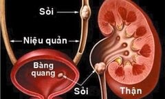 Video: Hai quả thận của bạn đã phải làm việc vất vả thế nào?