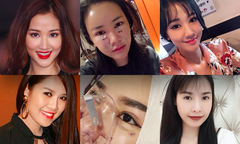 7 sao Việt không ngại công khai hình ảnh xấu xí sau khi dao kéo