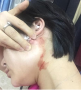 Tâm sự của chủ doanh nghiệp ‘nuôi ong tay áo’, bị nhân viên cũ hành hung