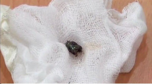 Bị côn trùng dài 2cm chui vào phổi, bé trai suýt mất mạng