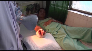 Xót lòng những đứa trẻ lăn lộn mưu sinh, mất đi một phần thân thể vì tai nạn lao động