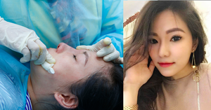 Hậu ly hôn Lâm Vinh Hải, Lý Phương Châu chi trăm triệu phẫu thuật thẩm mỹ