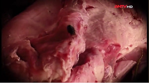 Thịt lợn giá 'rẻ như bèo': Toàn thịt ôi thiu, hôi thối và không rõ nguồn gốc!