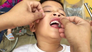 Bố dùng xe máy nhổ răng cho con trai khiến dân mạng 'cười chảy nước mắt'