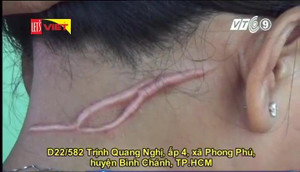 Bị hàng xóm vô cớ dùng dao cứa cổ, người phụ nữ phải sống trong sợ hãi