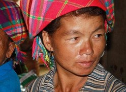 Chuyện lạ ở Yên Bái: Hàng loạt phụ nữ không hiểu sao bỗng dưng bị… móm