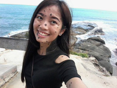 Cô gái có hàng trăm nốt ruồi giăng kín người vẫn tự tin đi thi Hoa hậu hoàn vũ