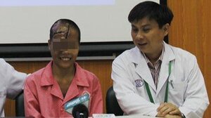 Tưởng phải mang khối bướu trên mặt suốt đời, cô gái hạnh phúc khi được phẫu thuật miễn phí