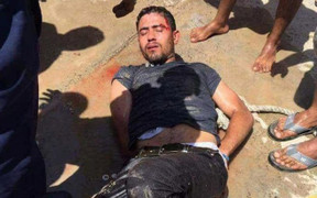 Gã điên dùng dao đâm chết 2 du khách tại khu nghỉ dưỡng nổi tiếng