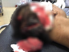 Đoàn quân côn đồ mang súng, dao kiếm truy sát kinh hoàng làng quê Hải Dương như chốn vô pháp luật