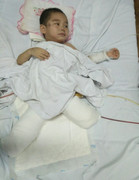 Kêu gọi hỗ trợ cháu bé mất hai chân do sạt lở đất ở Sơn La