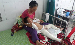 Nghịch xăng, bé trai 4 tuổi bị bỏng nặng