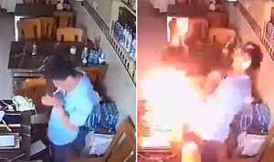 Châm lửa hút thuốc, bật lửa nổ tung cháy sém mặt