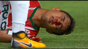 Video: Cầu thủ Mexico đạp nhau chảy máu mặt trong trận đấu rợn người