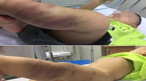 Bé trai 14 tháng tuổi nghi bị bạo hành, bỏ rơi tại bệnh viện: Thông tin mới nhất