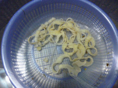 Choáng: Con sán xơ mít dài 8m trong người bệnh nhân