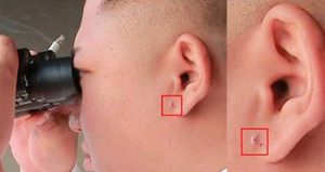 Tai của ông Kim Jong-un che giấu bí mật gì mà Triều Tiên phải liên tục chỉnh sửa?