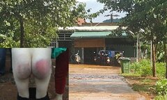 Cô giáo dùng thước đánh bầm dập mông học sinh khiến phụ huynh phẫn nộ