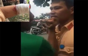 Sự thật thông tin tài xế 'tố' bị CSGT Hải Dương đánh rách môi