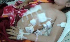 Trút 'mưa dao' đâm vợ nhân tình suýt mất mạng: Hành vi quyết đoạt mạng đến cùng, cần truy tố tội 'Giết người'