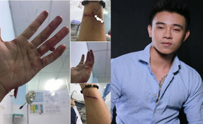 Top 3 Vietnam Idol bị chủ nợ của mẹ chém rách tay