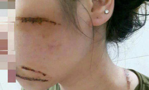 Tưởng nhầm chủ quán, nhóm côn đồ xông vào tiệm Spa chém kinh hoàng nữ nhân viên