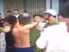 Đại uý công an bị 5 thanh niên đánh thương tích ở Bình Dương