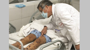 Đừng nhầm sốt xuất huyết với bệnh có thể chết trong vòng 24 giờ