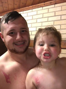 Xúc động khi biết lý do cha và con gái đều có vết sẹo giống nhau trên ngực