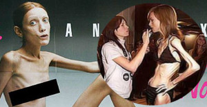 Có nên để người mẫu siêu gầy xuất hiện trên sàn diễn thời trang?