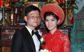 Điểm mặt những đám cưới 'lệch pha' khiến ai nấy đều xúc động vì tình yêu chân thành