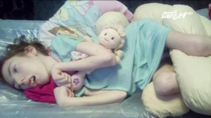 Bé gái tật nguyền suốt đời vì nụ hôn 'tử thần' của mẹ