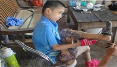 Tận cùng nỗi đau của cậu bé mắc bệnh lạ, u mọc nhiều như nấm ở Bắc Giang