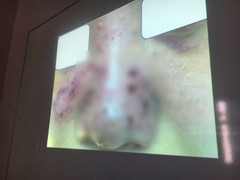 ​Thẩm mỹ chui ở chung cư, bỏ 1 đồng trả giá gấp 10 lần