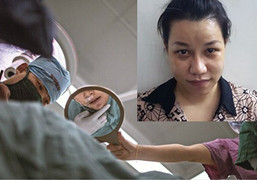 Nữ trưởng phòng tham ô hơn 4 tỷ đồng đi sửa sắc đẹp