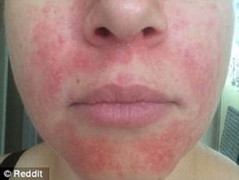 Tác dụng bất ngờ của 'thần dược' mật ong