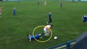 Bị đối phương đá vào hạ bộ, cầu thủ phải phẫu thuật cắt bỏ tinh hoàn