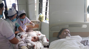 Đốt đèn dầu bắt muỗi, mẹ con bệnh nhi bỏng nặng nhập viện