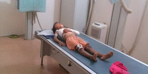 Phụ huynh 'tố' nhà trường thờ ơ khi học sinh bị cửa sắt đè gãy xương: Hiệu trưởng lên tiếng