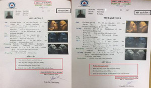 Bệnh viện 16A Hà Đông: Một bệnh nhân đi khám, hai kết quả khác nhau