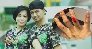 Đăng ảnh bị chồng đánh rồi xóa ngay, vợ Xuân Bắc nói gì?